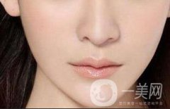 玻尿酸垫下巴会毁容吗？注意事项有哪些？