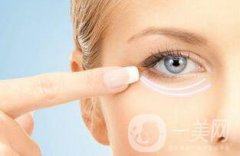 自体脂肪填充泪沟后遗症有哪些？