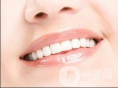 种植牙好不好 种植牙果如何