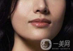 鹰钩鼻矫正有哪些注意事项呢?