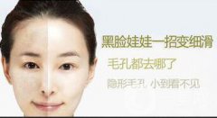 黑脸娃娃的功与作用介绍，关于皮肤管理的干货也有哦