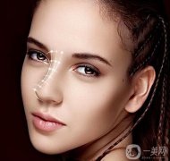 耳软骨隆鼻多少钱？