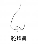 驼峰鼻矫正整形价格是多少？