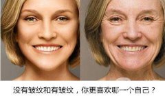 怎样减少脸上的皱纹 除皱方式盘点附价格介绍