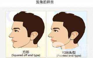 鬓角种植术后护理 护理注意事项有哪些