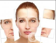 4D埋线拉皮能维持多久 果好不好