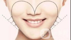 自体脂肪面部填充果好不好？有哪些果？