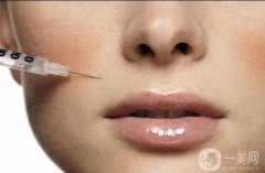 伊维兰注射隆鼻果怎么样 果可以保持多久