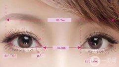 韩式*开眼角手术的价格高吗？