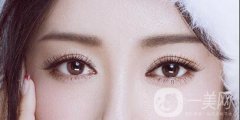 高分子割双眼皮可以维持多长时间呢?注意事项有哪些？