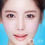 注射去皱后时间久了皱纹会变得更糟吗？