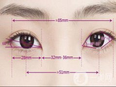 什么人适合开眼角 开眼角需要注意什么