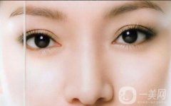 双眼皮怎么样？果如何呢？
