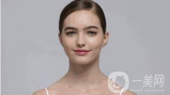 去抬头纹要多少钱 去抬头纹的手术方法