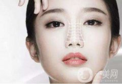 硅橡胶隆鼻要多少钱 硅橡胶隆鼻材料