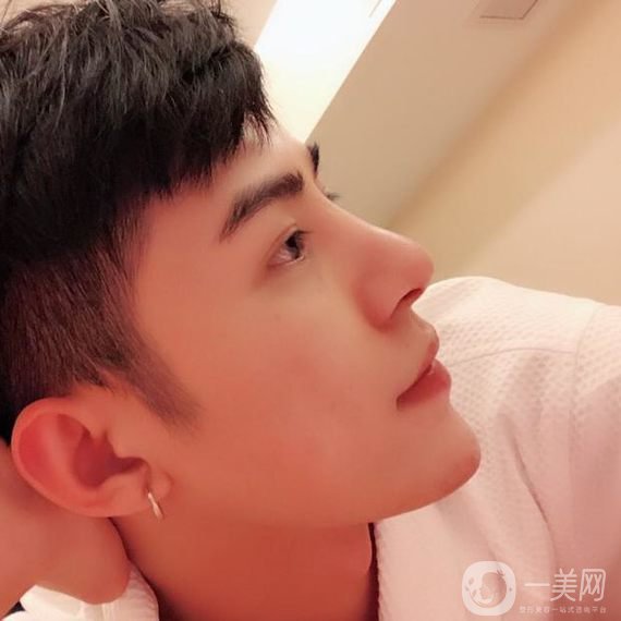 上海华美男士肋软骨隆鼻234天恢复日记