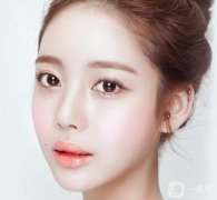 韩式开眼角手术果怎么样？
