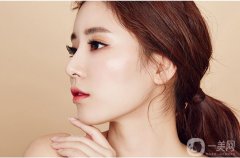 成都割双眼皮多少钱？费用高吗？