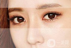 做三点定位双眼皮眼睛疼吗？可以打麻醉吗？