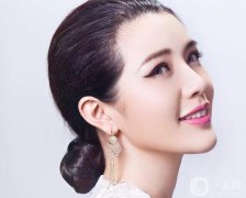 面部脂肪填充通常费用高吗 果好不好