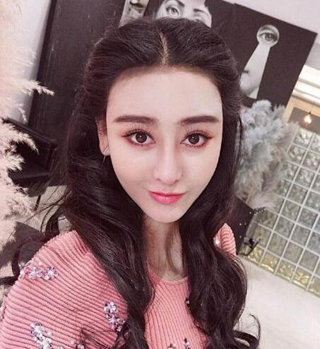 又一个整容失败的女明星，鼻子都整歪了，不甘心扬言还要植发！