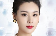 注射隆鼻前后图 注射隆鼻果好不好？