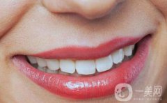 做牙齿矫正肿胀如何消肿 牙齿矫正的*佳年龄