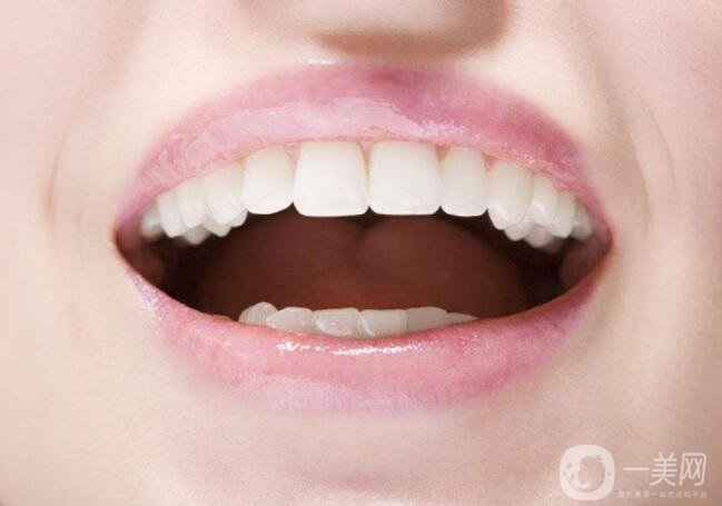 牙齿矫正肿胀如何消肿？了解牙齿矫正的最佳年龄！
