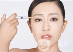 玻尿酸额头一般打几针*果?
