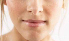 果酸祛痘副作用有哪些 果酸祛痘后遗症