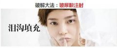 玻尿酸填充泪沟的危害 果怎么样