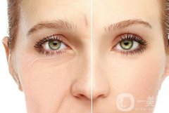 医美抗衰干货：女孩过了25岁就老了？那是你不知道年轻化的秘密