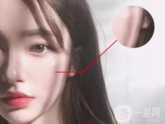 磨颧骨果怎么样 有什么风险吗？