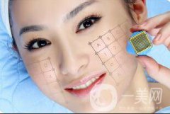 热玛吉和超生刀信息介绍 有什么区别