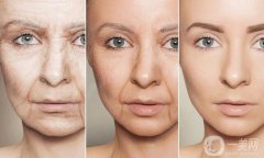 抗衰老除皱的调节方式有哪些呢？