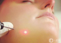 像素激光祛疤价格贵吗？多少钱？