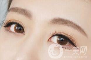 韩式三点双眼皮价格, 韩式三点双眼皮和埋线区别