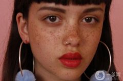 色素沉着如何处理 怎么去除？