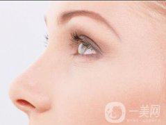 做个鼻翼缩一次多少钱？影响价格的因素有哪些？