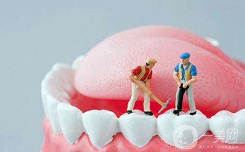洗牙的利与弊有哪些 洗牙有副作用吗