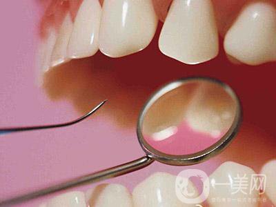 洗牙的利与弊有哪些 洗牙有副作用吗