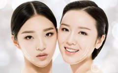 双下巴怎么形成的 如何去掉双下巴？