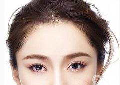 种发际线果图 种发际线果明X吗