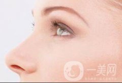 北京驼峰鼻矫正好吗?果怎么样?