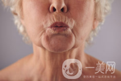 出现烟民线该如何解决呢？