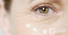 眼角除皱手术多少钱 眼角除皱的方法