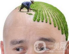 头发种植术多少钱?如何判断?