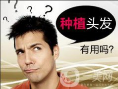 植发的危害有什么?优点和价格介绍?
