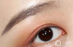 上眼皮吸脂价格多少？上眼皮吸脂后变双眼皮？