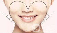 脂肪填充脸能维持几年？